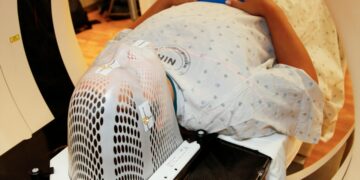 Equipamento de diagnóstico por imagem em ambiente hospitalar, usado como imagem ilustrativa para matéria sobre novo contraste de ressonância